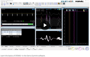 Learn the basics of SFEMG+ in the Sierra Summit software
