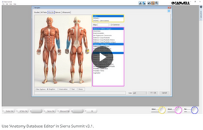 Use ‘Anatomy Database Editor’ in Sierra Summit v3.1.